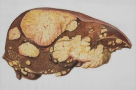 liver