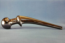 Hip joint