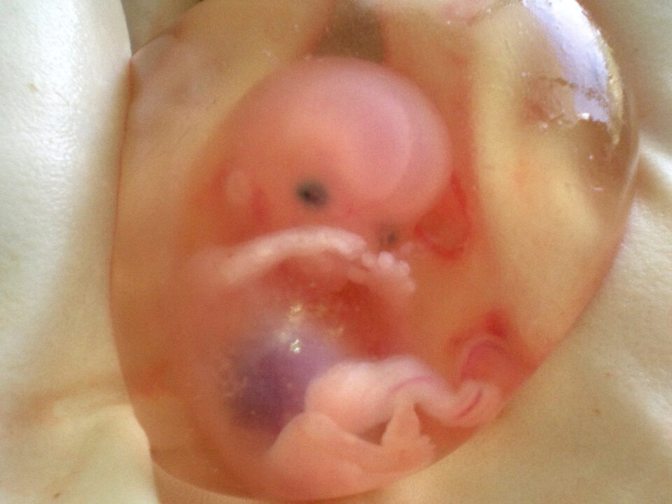 Human fetus