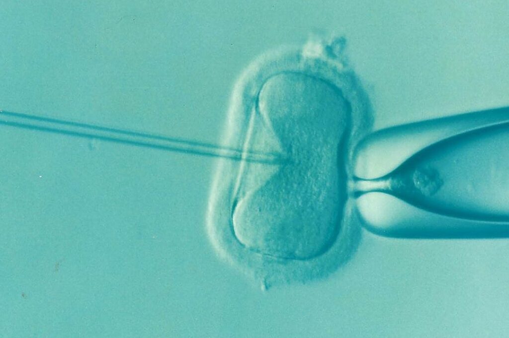 Ivf invitro