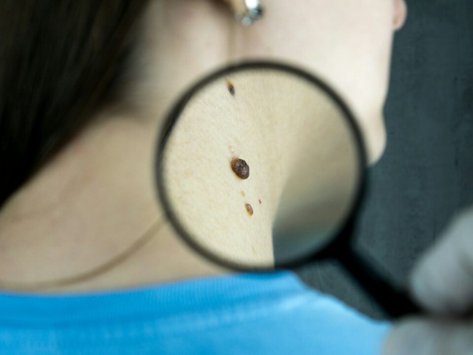 dermatology