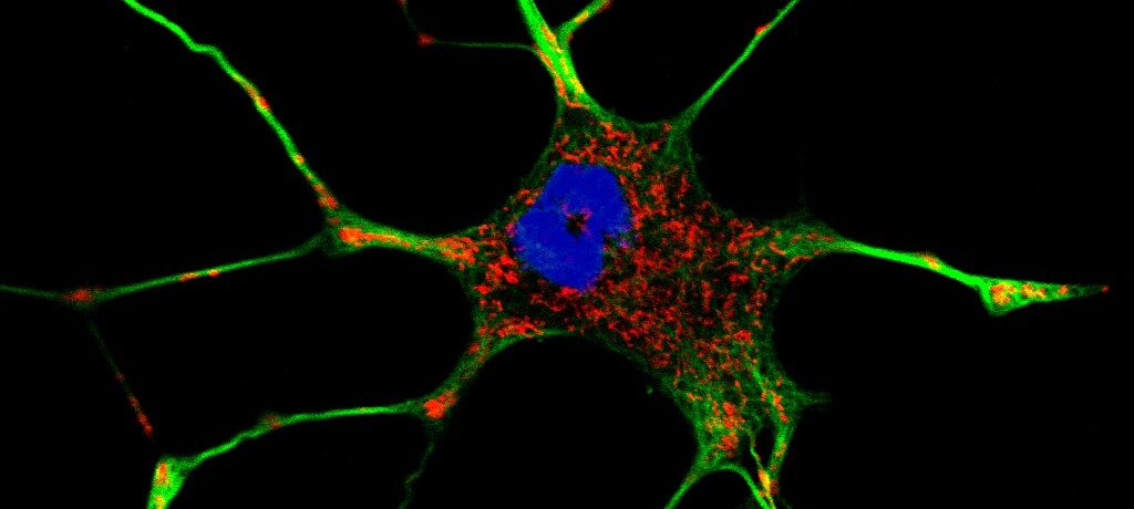 Multicolor fluorescence image of a living cancer cell