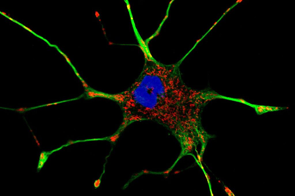 Multicolor fluorescence image of a living cancer cell
