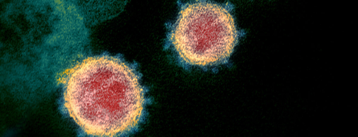 Coronavirus
