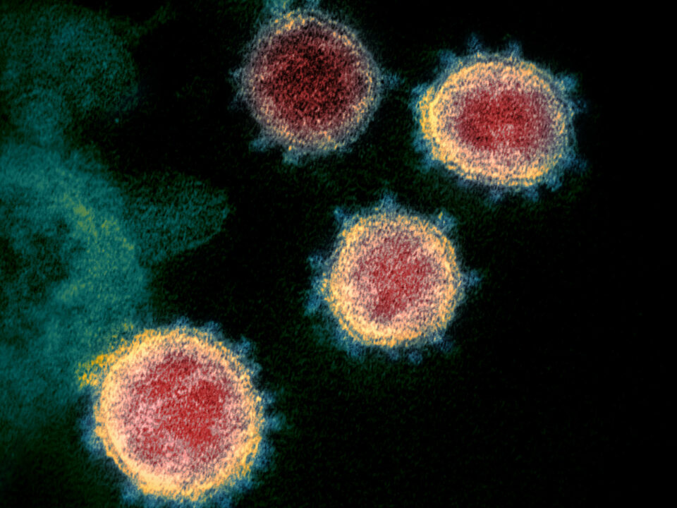 Coronavirus