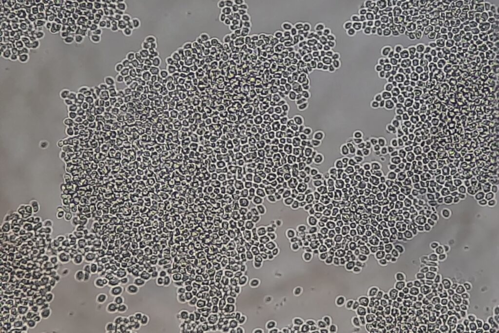 Nakaseomyces glabratus