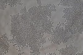Nakaseomyces glabratus