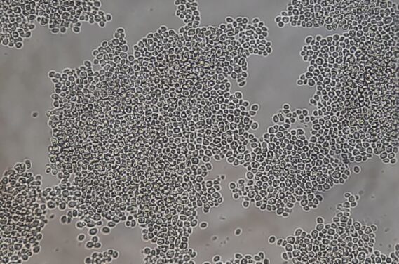 Nakaseomyces glabratus