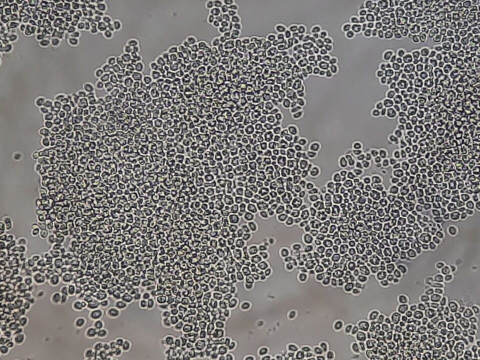 Nakaseomyces glabratus