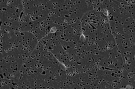 Sperm