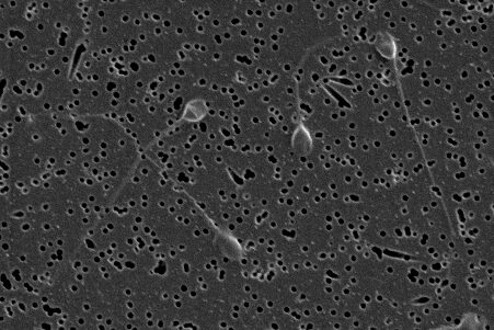 Sperm