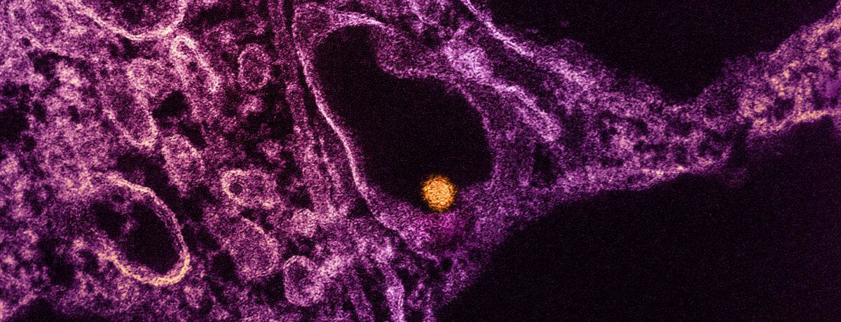 West Nile Virus