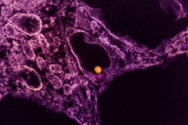 West Nile Virus