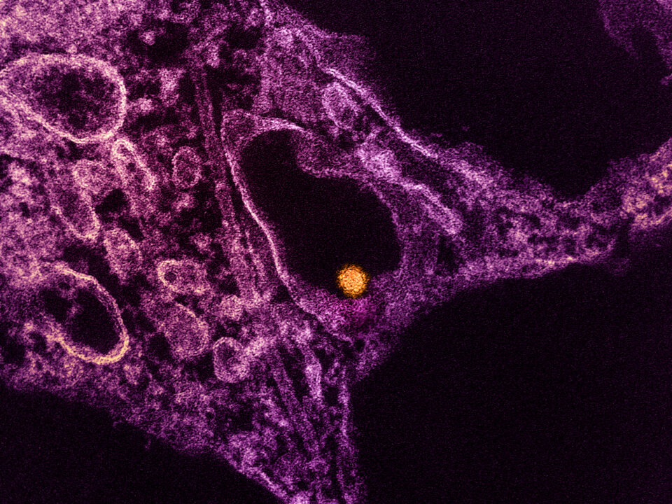 West Nile Virus