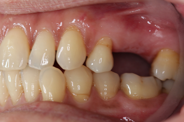 teeth