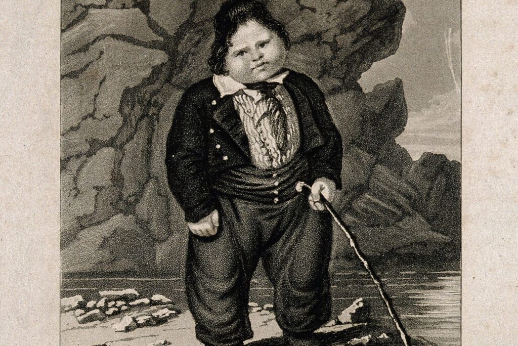 obese child