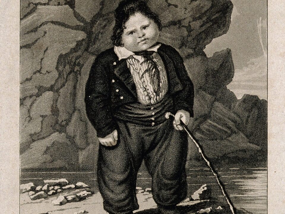 obese child