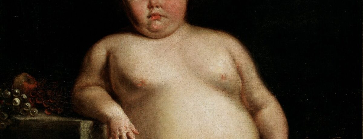 obese child