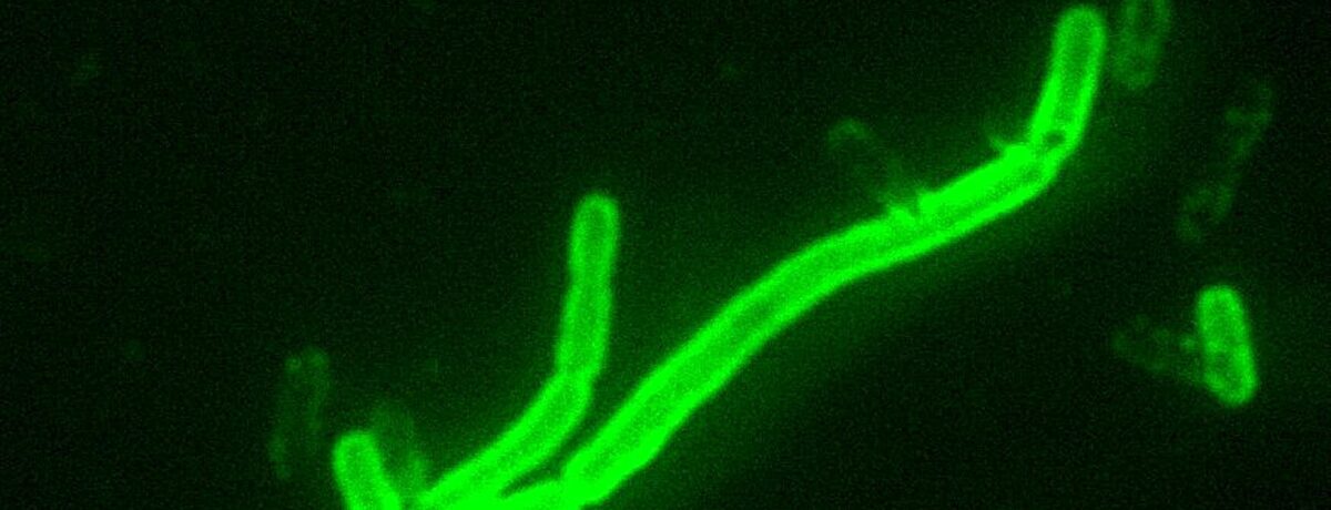 Yersinia pestis pneumonic plague