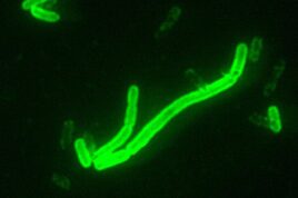 Yersinia pestis pneumonic plague
