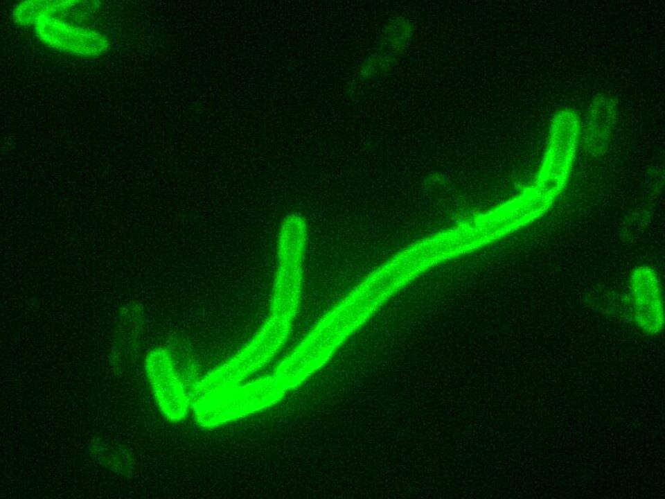 Yersinia pestis pneumonic plague