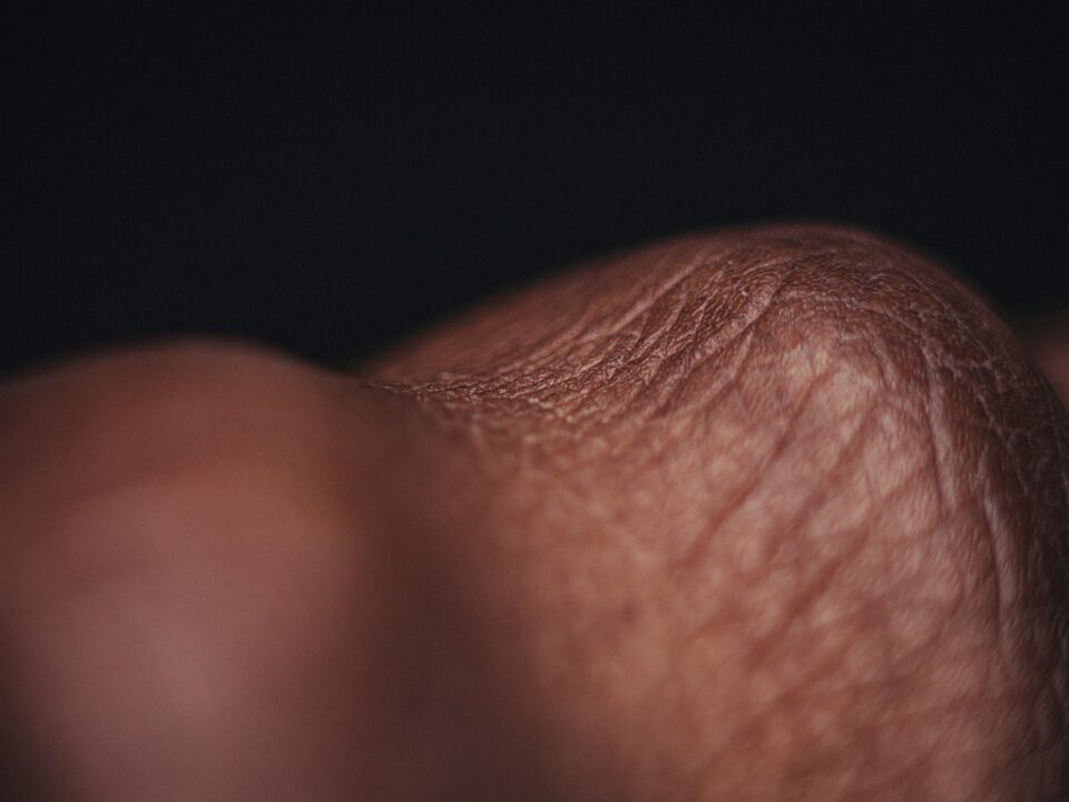 skin