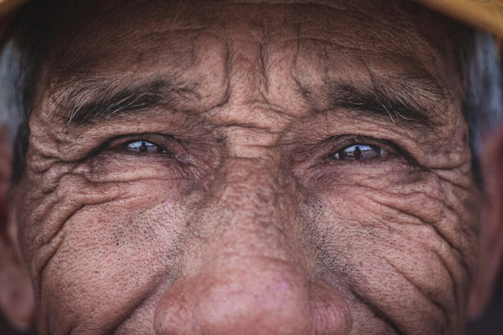 age old wrinkles