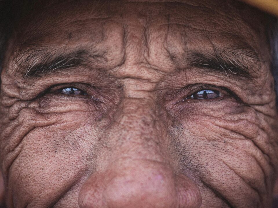 age old wrinkles